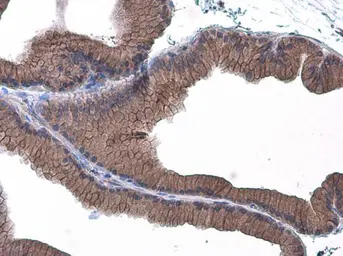 Anti-E-Cadherin antibody used in IHC (Paraffin sections) (IHC-P). GTX100443