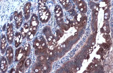 Anti-E-Cadherin antibody used in IHC (Paraffin sections) (IHC-P). GTX100443