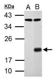 Anti-p21 Cip1 antibody used in Western Blot (WB). GTX100444
