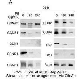 Anti-p27 Kip1 antibody used in Western Blot (WB). GTX100446