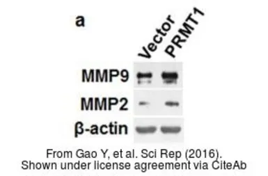 Anti-MMP9 antibody [N2C1], Internal used in Western Blot (WB). GTX100458