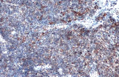 Anti-MMP9 antibody [N2C1], Internal used in IHC (Paraffin sections) (IHC-P). GTX100458