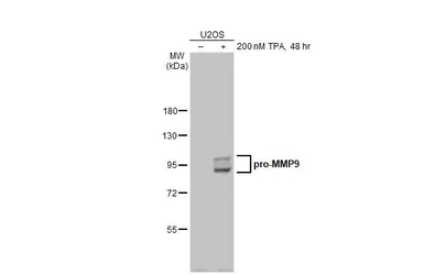 Anti-MMP9 antibody [N2C1], Internal used in Western Blot (WB). GTX100458