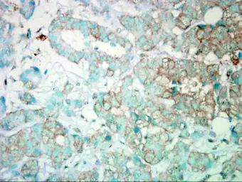 Anti-PI3 kinase p110 alpha antibody used in IHC (Paraffin sections) (IHC-P). GTX100462