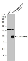 Anti-Urokinase antibody used in Western Blot (WB). GTX100465