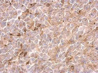 Anti-Urokinase antibody used in IHC (Paraffin sections) (IHC-P). GTX100465