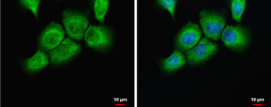 Anti-uPAR antibody used in Immunocytochemistry/ Immunofluorescence (ICC/IF). GTX100467