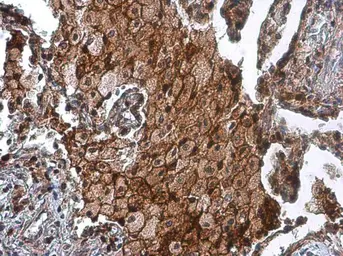 Anti-uPAR antibody used in IHC (Paraffin sections) (IHC-P). GTX100467