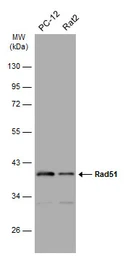 Anti-Rad51 antibody [N1C2] used in Western Blot (WB). GTX100469