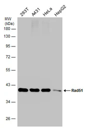 Anti-Rad51 antibody [N1C2] used in Western Blot (WB). GTX100469