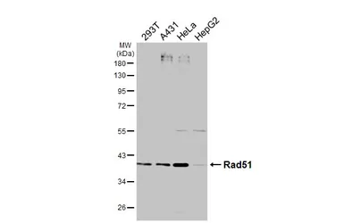 Anti-Rad51 antibody [N1C2] used in Western Blot (WB). GTX100469