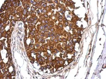 Anti-Aladin antibody [N2C2], Internal used in IHC (Paraffin sections) (IHC-P). GTX100475
