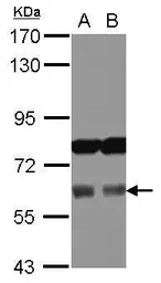 Anti-Aladin antibody [N2C2], Internal used in Western Blot (WB). GTX100475