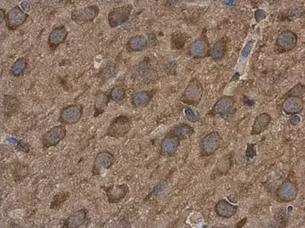 Anti-ABAT antibody used in IHC (Paraffin sections) (IHC-P). GTX100479