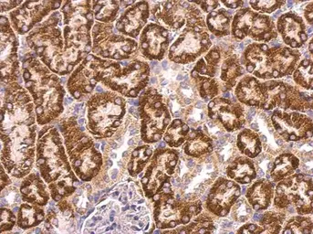 Anti-ABAT antibody used in IHC (Paraffin sections) (IHC-P). GTX100479