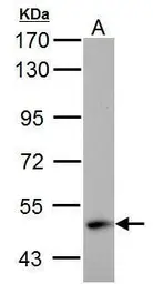 Anti-ABAT antibody used in Western Blot (WB). GTX100479