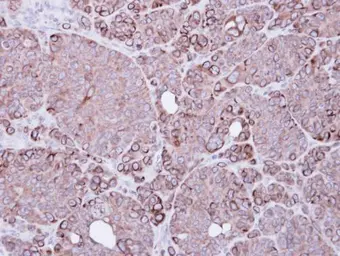 Anti-XIAP antibody [C1C3] used in IHC (Paraffin sections) (IHC-P). GTX100496