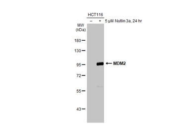 Anti-MDM2 antibody used in Western Blot (WB). GTX100531