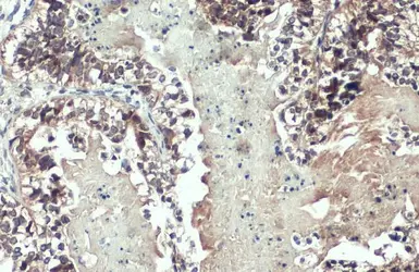 Anti-MMP1 antibody used in IHC (Paraffin sections) (IHC-P). GTX100534