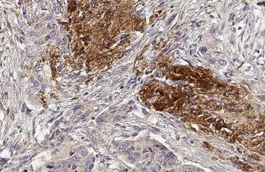 Anti-MMP1 antibody used in IHC (Paraffin sections) (IHC-P). GTX100534
