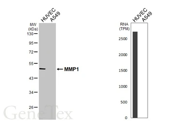 Anti-MMP1 antibody used in Western Blot (WB). GTX100534