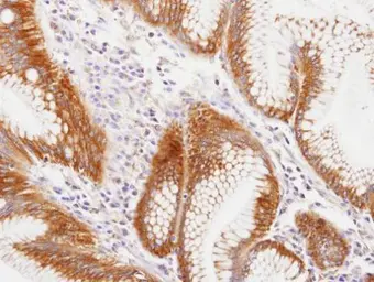 Anti-MVP/LRP antibody [C2C3], C-term used in IHC (Paraffin sections) (IHC-P). GTX100536