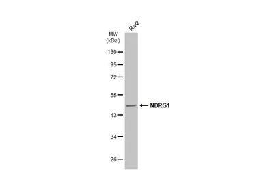 Anti-NDRG1 antibody used in Western Blot (WB). GTX100537