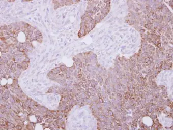 Anti-Cytokeratin 15 antibody used in IHC (Paraffin sections) (IHC-P). GTX100572