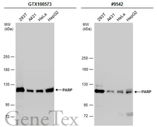 Anti-PARP antibody used in Western Blot (WB). GTX100573