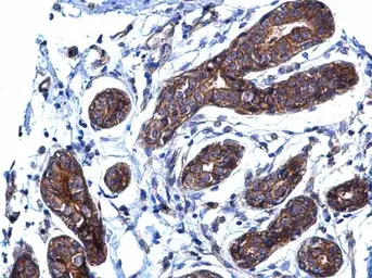 Anti-p130Cas antibody [N2C2], Internal used in IHC (Paraffin sections) (IHC-P). GTX100605
