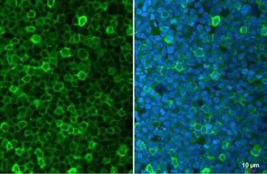 Anti-Cystatin F antibody used in Immunocytochemistry/ Immunofluorescence (ICC/IF). GTX100613