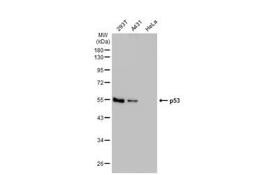 Anti-p53 antibody [N1], N-term used in Western Blot (WB). GTX100629