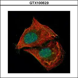 Anti-p53 antibody [N1], N-term used in Immunocytochemistry/ Immunofluorescence (ICC/IF). GTX100629