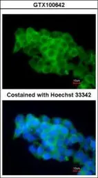 Anti-CD36 antibody [C1C3] used in Immunocytochemistry/ Immunofluorescence (ICC/IF). GTX100642