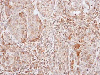 Anti-SOCS1 antibody used in IHC (Paraffin sections) (IHC-P). GTX100657