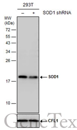 Anti-SOD1 antibody used in Western Blot (WB). GTX100659