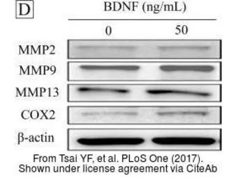 Anti-MMP13 antibody [N3C1], Internal used in Western Blot (WB). GTX100665