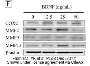 Anti-MMP13 antibody [N3C1], Internal used in Western Blot (WB). GTX100665