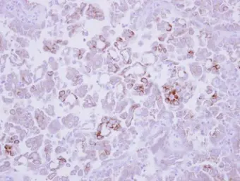 Anti-MMP13 antibody [N3C1], Internal used in IHC (Paraffin sections) (IHC-P). GTX100665