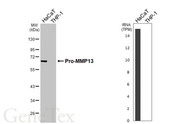 Anti-MMP13 antibody [N3C1], Internal used in Western Blot (WB). GTX100665