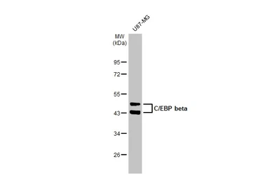 Anti-C/EBP beta antibody used in Western Blot (WB). GTX100675