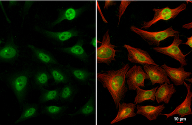 Anti-C/EBP beta antibody used in Immunocytochemistry/ Immunofluorescence (ICC/IF). GTX100675