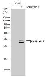 Anti-Kallikrein 7 antibody used in Western Blot (WB). GTX100700