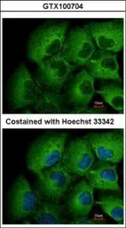 Anti-MMP12 antibody [N3C1], Internal used in Immunocytochemistry/ Immunofluorescence (ICC/IF). GTX100704