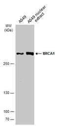 Anti-BRCA1 antibody [C3], C-term used in Western Blot (WB). GTX100720