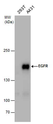 Anti-EGFR antibody [N1], N-term used in Western Blot (WB). GTX100725