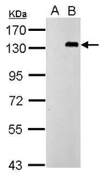 Anti-TLR9 antibody [N2], N-term used in Western Blot (WB). GTX100726