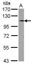 Anti-TLR9 antibody [N2], N-term used in Western Blot (WB). GTX100726