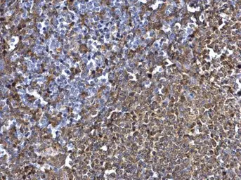 Anti-Syk antibody [N2C2], Internal used in IHC (Paraffin sections) (IHC-P). GTX100748