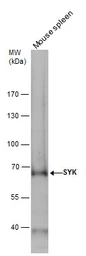 Anti-Syk antibody [N2C2], Internal used in Western Blot (WB). GTX100748